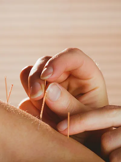 séance d'acupuncture à Aubenas, dans le cabinet d'Andréa Roy